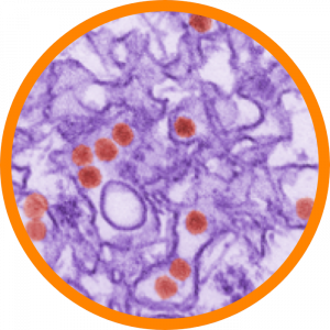 Microscopic enlargement of Zika