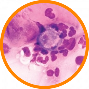 Microscopic enlargement of acanthamoeba