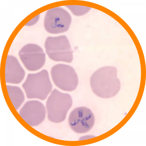 Microscopic enlargement of Babesia