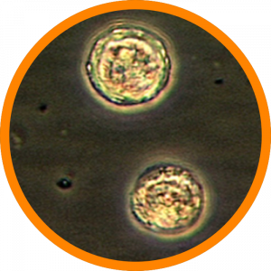 Microscopic enlargement of Balamuthia