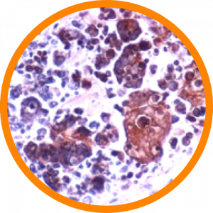 Microscopic enlargement of Herpesviridae