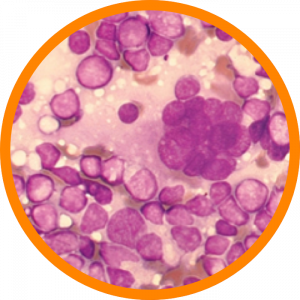 Microscopic enlargement of HIV