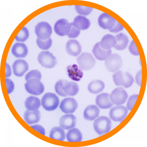Microscopic enlargement of Malaria