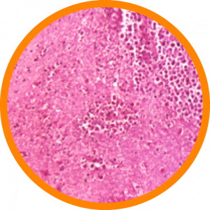 Microscopic enlargement of Naegleria fowleri 