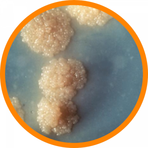 Microscopic enlargement of Tuberculosis