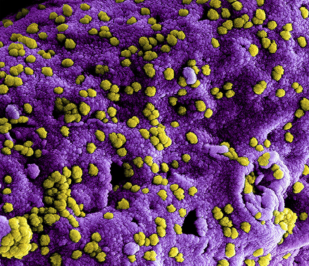 virus