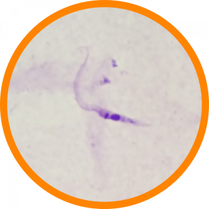 Microscopic enlargement of Chagas 