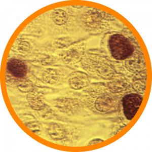 Microscopic enlargement of Chlamydia trachomatis