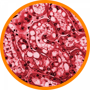 Microscopic enlargement of Cholera