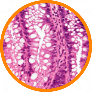 Microscopic enlargement of Cryptosporidiosis