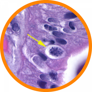 Microscopic enlargement of Cystoisospora belli