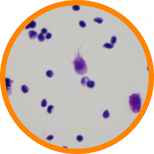 Microscopic enlargement of Giardia