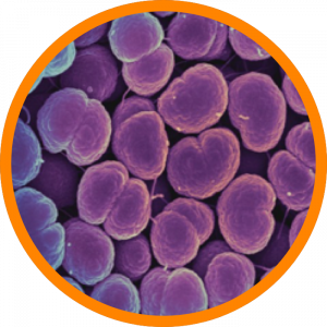 Microscopic enlargement of Gonorrhea