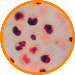 Microscopic enlargement of Legionella