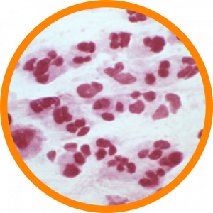 Microscopic enlargement of Mycoplasma genitalium