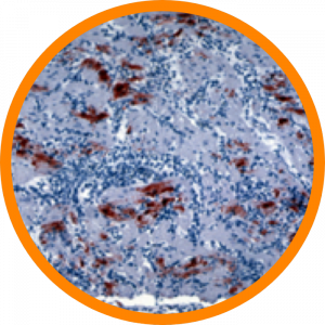 Microscopic enlargement of Newcastle disease virus