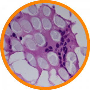 Microscopic enlargement of Phagocytes
