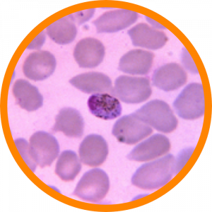 Microscopic enlargement of Babesia