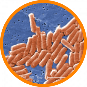 Microscopic enlargement of Salmonella