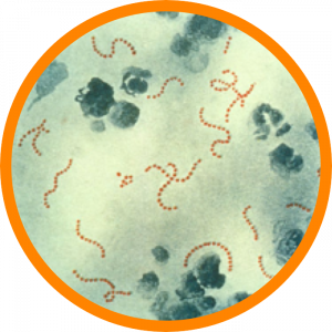 Microscopic enlargement of Staphylococcus