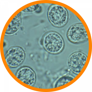 Microscopic enlargement of Toxoplasma gondii